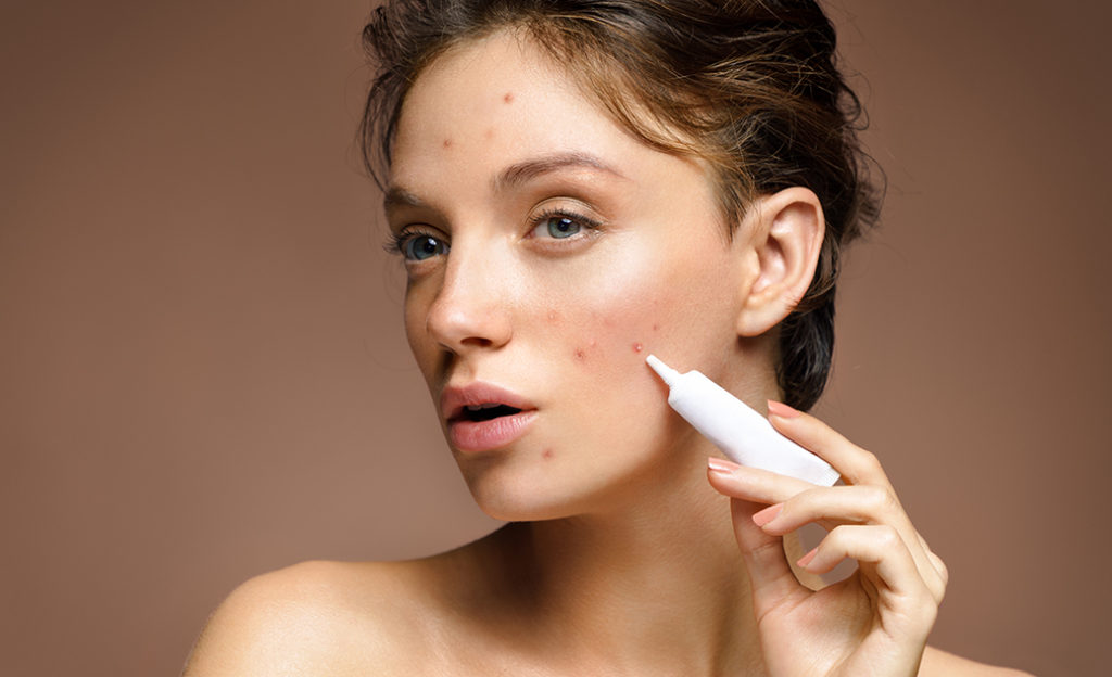 ✓ María Pombo recomienda para el acné pero es un mal consejo para tu piel, tu salud y medio ambiente